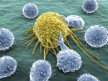 A cancer cell under attack by lymphocytes