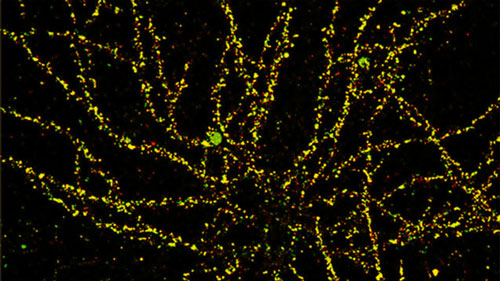 Fluorescent amyloid beta oligomers (green), bound to cultured hippocampal neurons
