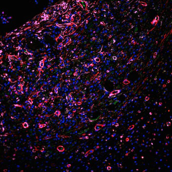 infiltration of robust blood vessels (red) in a hydrogel scaffold