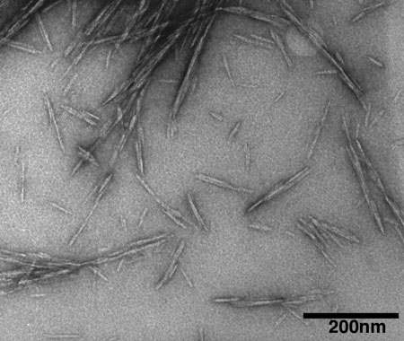 transmission electron microscope image showing cellulose nanocrystals
