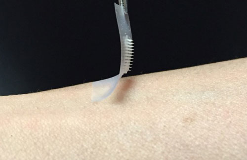 Microneedle-array patch