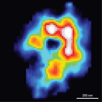 A map of the electron density of an algal chloroplast obtained using coherent x-ray diffraction imaging