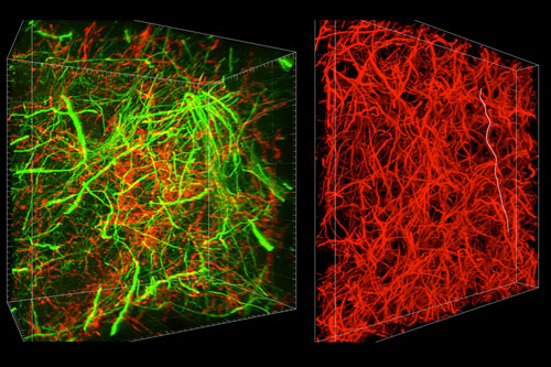 Imaging the Brain at Multiple Size Scales