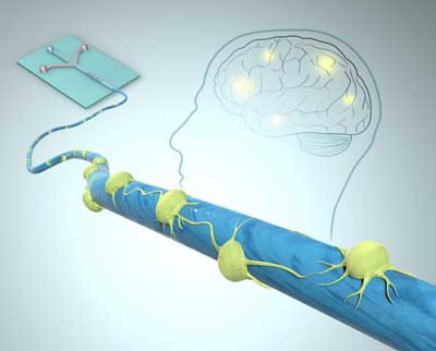 Microfibers for Tissue Engineering, Neural Stem Cells