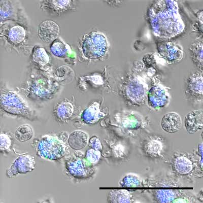 Macrophages with, in green, nanoparticles
