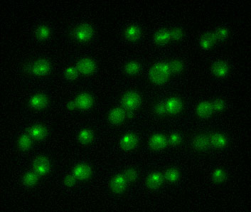 The picture shows yeast cells tagged with a green fluorescent protein that has been stressed with sodium chloride
