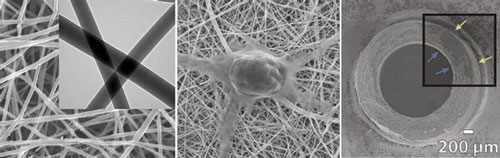 >The left panel shows a closeup of chitosan and polyester fibers woven at the nanometer scale. The middle panel shows a nerve cell growing on the resulting mesh, which has a texture similar to the body's fibrous connective tissue. The right panel shows a cross-section of the synthetic nerve guide. Arrows point to nerve cells that have attached to the inner and outer surfaces of the tube