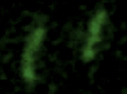 Fluorescent images of TB bacteria taken by the CellScope