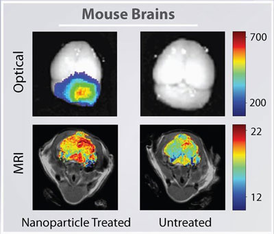 A mouse brain tumor imaged using nanoparticles (left column) or conventional techniques (right column) combined with optical imaging and MRI
