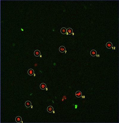 The fluorescent marking of the antibody