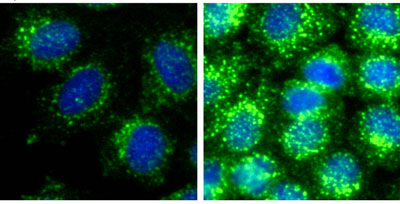 Cell-to-cell variability in clathrin-mediated endocytosis (green signal) is determined by local cell density