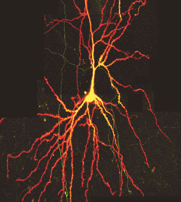 Two-photon-microscopy of neuron