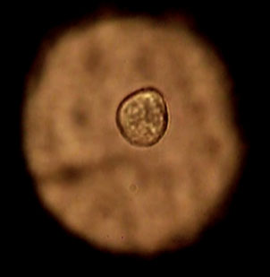 Cell trap, single tumour cell trapped in the centre of a microwell (top view).