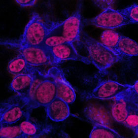 Mouse tumor cells stain red, showing penetration of anti-cancer drug after 24 hours