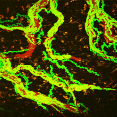 the movement of creeping T-cells (green) inside blood vessels (red)