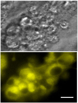 Fluorescent microscope images of unstained pancreatic alpha cells 