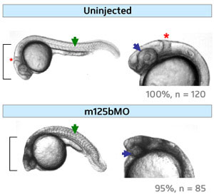 Images of zebrafish embryos demonstrating that miR125b contributes to proper development through its effects on p53 activity