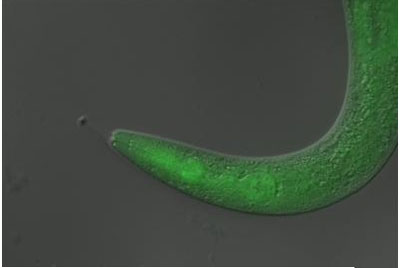 This tiny worm became temporarily paralyzed when scientists fed it a light-sensitive material, or 