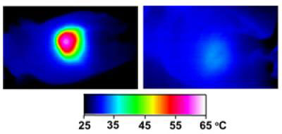 Infrared images made while tumors were irradiated with a laser show that in nanocage-injected mice (left), the surface of the tumor quickly became hot enough to kill cells. In buffer-injected mice (right), the temperature barely budged