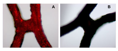 Two hours after local delivery of fluorescently labeled magnetic nanoparticles, the red areas indicate significantly larger amounts of nanoparticles in vascular stents in the presence of a magnetic field (A) compared to no magnetic field (B)