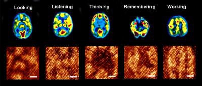 Magnetic resonance images of human brain during different functions