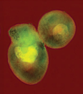 A pair of yeast cells imaged at very high resolution using coherent soft x-rays at the Advanced Light Source’s beamline 9.0.1. The coherent (laser-like) beam of penetrating x-rays allows a computer to reconstruct the cells’ internal structures from a diffraction pattern, without focusing the light with a lens. 