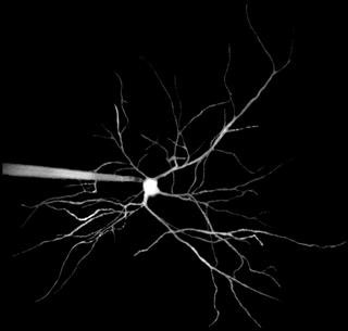 Dendrites of a nerve cell in brain appear like branches of a tree. Left: A patch clamp pipette injects fluorescent dye into the cell