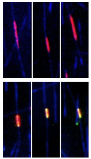 anti-parallel microtubule overlaps in vitro