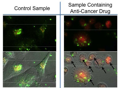 Images of nanoparticles taken up by breast cancer cells