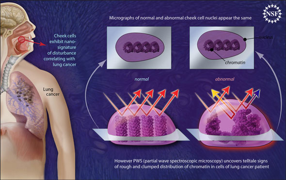 Nano-scale disturbances in cheek cells indicate the presence of lung cancer