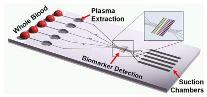 This schematic of the tether-free SIMBAS chip shows some of the functional elements, such as the blood loading area, the plasma separation microtrenches, detection sites and the suction flow structures.