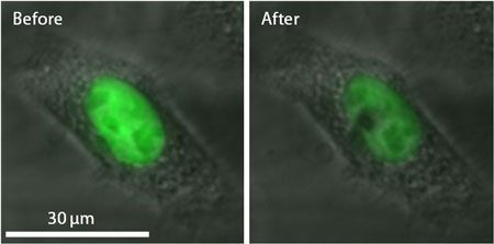 The nano-beam has been successfully used to selectively damage a nucleus (fluorescent green) in a cancer cell