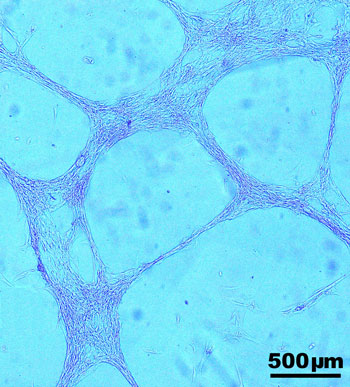 Cell in culture image taken with a optical microscope