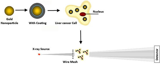 Gold nanoparticles with a polyelectrolyte coating can make smaller tumors more visible through X-ray scatter imaging