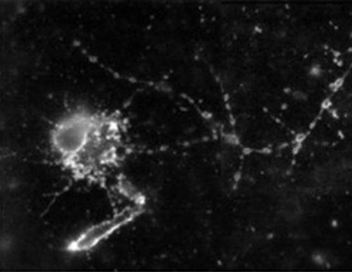A neuron in primary neuronal cultures generated from a brain of a fruit fly is aglow with ORMOSIL