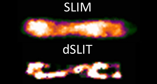 Comparison of a SLIM and dSLIT image of an E. coli cell