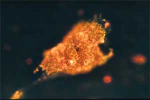 Image of cancer cell illuminated by gold nanorods