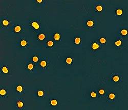 Gold nanoparticles; scanning electron micrograph