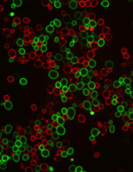 Fluorescent microscope image of fluorogen-activating proteins displayed on the surface of live yeast cells
