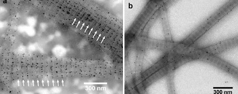 Transmission electron micrographs of reconstituted type I collagen fiber