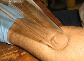 Sampling skin odour from a subject's forearm