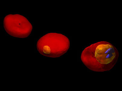 3D images of a human red blood cell invaded by malaria-inducing parasite Plasmodium falciparum