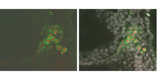 Sox2 is among the genes upregulated by Blimp1 as part of the PGC developmental program. These cells have been fluorescently labeled to illustrate this process; Blimp1-expressing cells are labeled green, Sox2 protein is labeled red