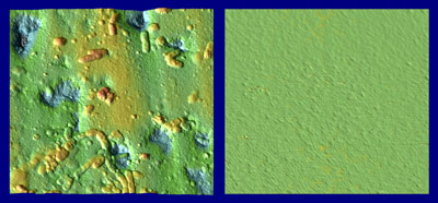 On the left, bacteria and roughness are clearly seen on the human tooth surface before nanoparticle polishing. On the right, the tooth surface after polishing.
