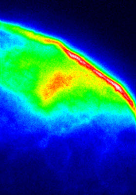 In this image, a tiny portion of a scale from a photonic beetle is viewed using a conventional fluorescence microscope
