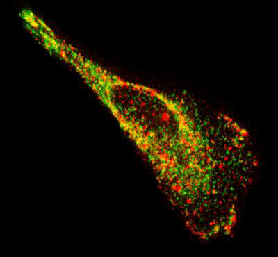 Image of a motile epithelial cell showing native mRNA (red) and a protein known to bind to mRNA (green)