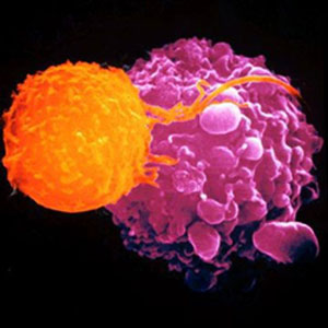 A T-cell (orange) kills a cancer cell (mauve)