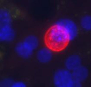 Plasmodium vivax growing in engineered liver tissue