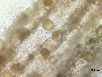 A microscopic image of the IBN hair follicle-like structures growing within a fibrous matrix