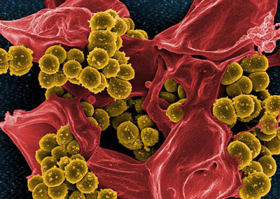Staphlyococcus aureus MRSA